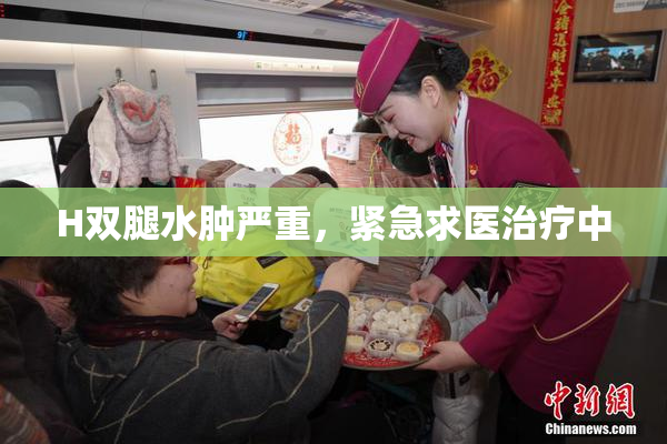 H双腿水肿严重，紧急求医治疗中