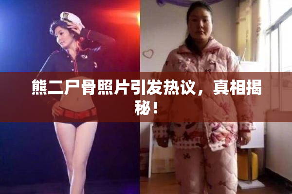 熊二尸骨照片引发热议，真相揭秘！