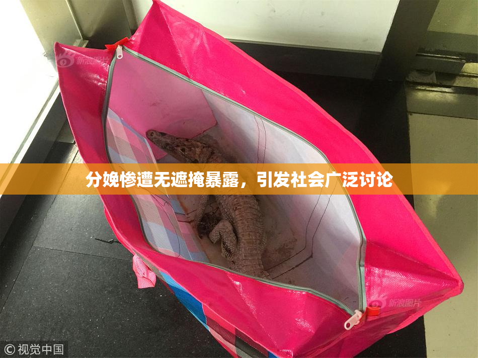 分娩惨遭无遮掩暴露，引发社会广泛讨论