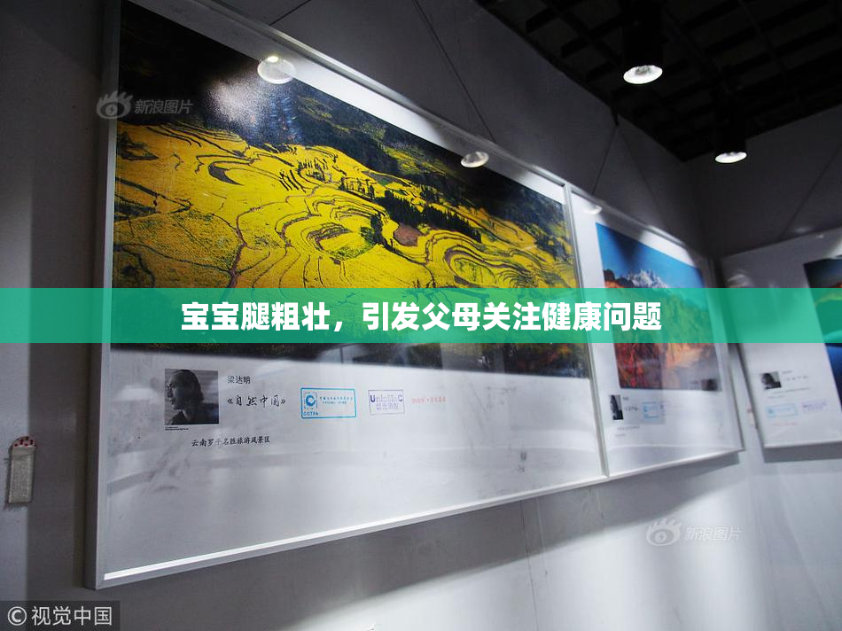 宝宝腿粗壮，引发父母关注健康问题