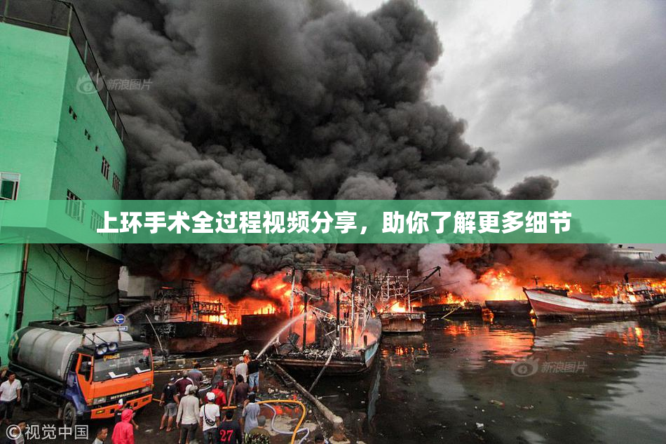 上环手术全过程视频分享，助你了解更多细节
