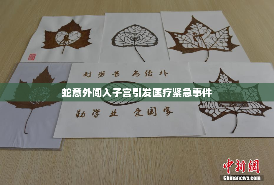 蛇意外闯入子宫引发医疗紧急事件