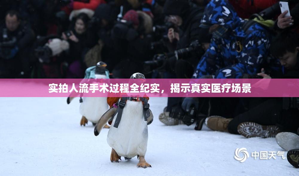 实拍人流手术过程全纪实，揭示真实医疗场景