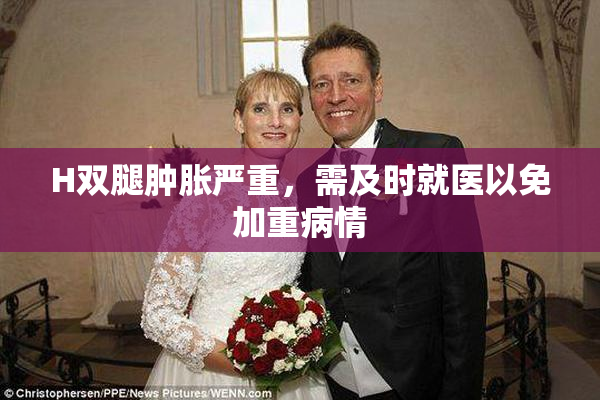 H双腿肿胀严重，需及时就医以免加重病情