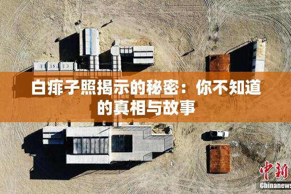 白痱子照揭示的秘密：你不知道的真相与故事