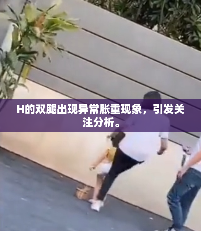 H的双腿出现异常胀重现象，引发关注分析。