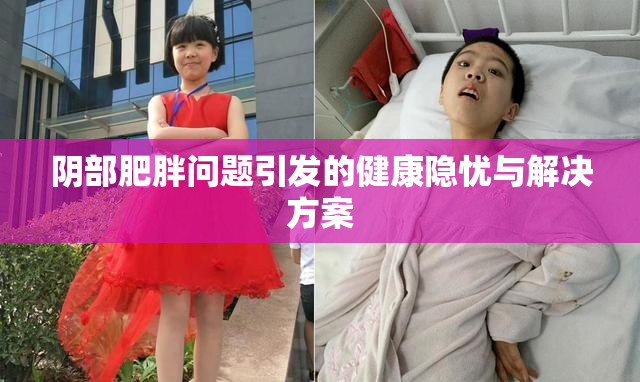 阴部肥胖问题引发的健康隐忧与解决方案