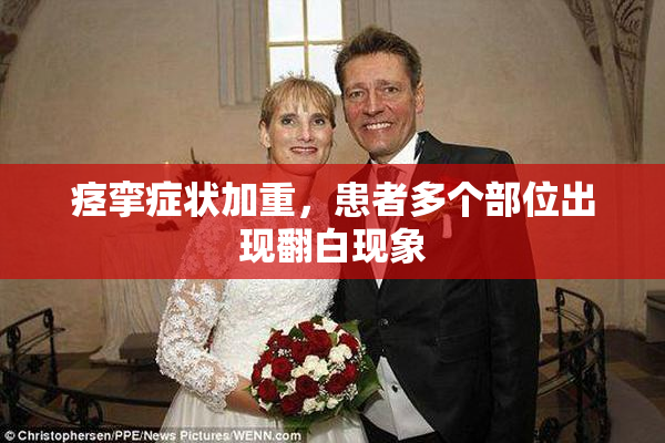 痉挛症状加重，患者多个部位出现翻白现象